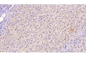 Detection of TFR in Human Liver Tissue using Monoclonal Antibody to Transferrin Receptor (TFR)
