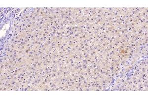 Detection of TFR in Human Liver Tissue using Monoclonal Antibody to Transferrin Receptor (TFR) (Transferrin Receptor anticorps  (AA 567-744))