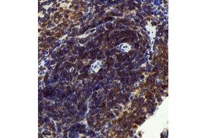 Immunohistochemistry of paraffin embedded rat spleen using CCR2 (ABIN7073453) at dilution of 1:1500 (400x lens) (CCR2 anticorps)