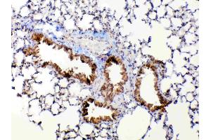 IHC analysis of MMP13 using anti-MMP13 antibody .