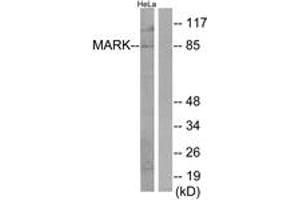 Western Blotting (WB) image for anti-MAP/microtubule Affinity-Regulating Kinase 1/2/3/4 (MARK1/2/3/4) (AA 121-170) antibody (ABIN2889783) (MARK1/2/3/4 anticorps  (AA 121-170))