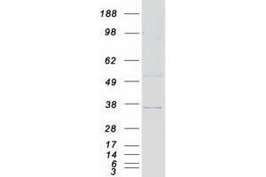 Validation with Western Blot