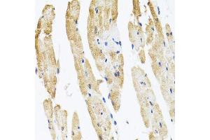 Immunohistochemistry of paraffin-embedded rat heart using COPB2 antibody. (COPB2 anticorps  (AA 657-906))