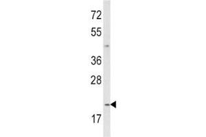 Western blot analysis of IL-12 antibody and MDA-MB231 lysate.
