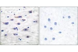 Immunohistochemistry analysis of paraffin-embedded human brain tissue, using GluR1 (Ab-863) Antibody. (Glutamate Receptor 1 anticorps  (AA 829-878))