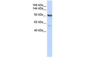 WB Suggested Anti-MTHFD1 Antibody Titration:  0. (MTHFD1 anticorps  (N-Term))