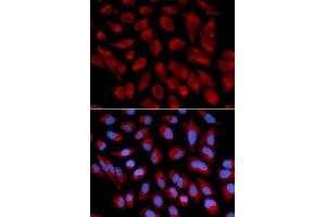 Immunofluorescence analysis of U2OS cell using AIFM1 antibody. (AIF anticorps  (AA 334-613))