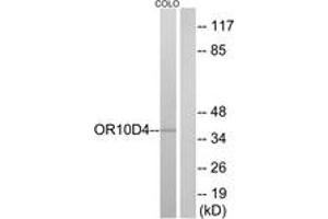 Western blot analysis of extracts from COLO cells, using OR10D4 Antibody. (OR10D4P anticorps  (AA 161-210))