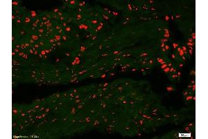 Formalin-fixed and paraffin-embedded human colon carcinoma labeled with Anti-DATF1/IDO1 Polyclonal Antibody, Unconjugatedused at 1:200 dilution for 40 minutes at 37°C