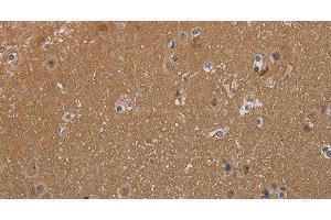 Immunohistochemistry of paraffin-embedded Human brain tissue using MAGEL2 Polyclonal Antibody at dilution 1:40 (MAGE-Like 2 anticorps)