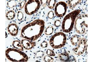 Image no. 16 for anti-5'-Nucleotidase Domain Containing 1 (NT5DC1) antibody (ABIN1499837)