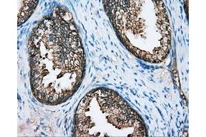 Immunohistochemical staining of paraffin-embedded Kidney tissue using anti-DNTTIP1 mouse monoclonal antibody.