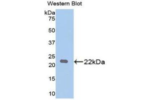 Western blot analysis of the recombinant protein. (PARK7/DJ1 anticorps  (AA 1-189))
