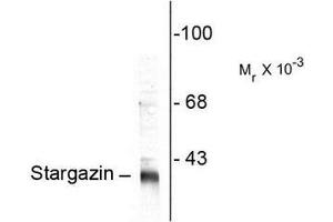 Image no. 1 for anti-Calcium Channel, Voltage-Dependent, gamma Subunit 2 (CACNG2) (C-Term) antibody (ABIN372715) (Stargazin anticorps  (C-Term))