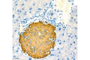 Immunohistochemistry of paraffin embedded rat pancreas+LPS using MADCAM1 (ABIN7074695) at dilution of 1:3400 (400x lens) (MADCAM1 anticorps)