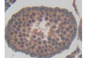 Detection of TUBd in Rat Testis Tissue using Polyclonal Antibody to Tubulin Delta (TUBd)