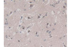 Used in DAB staining on fromalin fixed paraffin-embedded Liver tissue