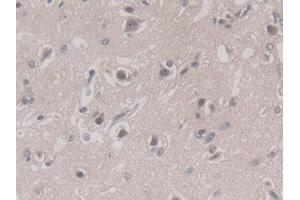 Used in DAB staining on fromalin fixed paraffin-embedded Liver tissue (PGC anticorps  (AA 61-388))