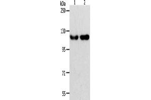 Gel: 8 % SDS-PAGE, Lysate: 40 μg, Lane 1-2: Hela cells, Jurkat cells, Primary antibody: ABIN7189608(ABL2 Antibody) at dilution 1/400, Secondary antibody: Goat anti rabbit IgG at 1/8000 dilution, Exposure time: 2 minutes (ABL2 anticorps)