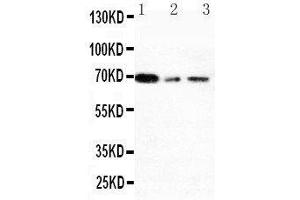 Anti-XRCC1 antibody, Western blotting Lane 1: 293T Cell Lysate Lane 2: A431 Cell Lysate Lane 3: HELA Cell Lysate