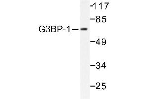 Image no. 1 for anti-GTPase Activating Protein (SH3 Domain) Binding Protein 1 (G3BP1) antibody (ABIN265425) (G3BP1 anticorps)