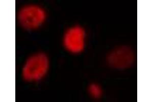 ABIN6274435 staining HT29 cells by IF/ICC. (IPMK anticorps  (Internal Region))