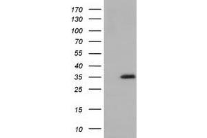 Western Blotting (WB) image for anti-Short Chain Dehydrogenase/reductase Family 9C, Member 7 (SDR9C7) antibody (ABIN1500841) (SDR9C7 anticorps)