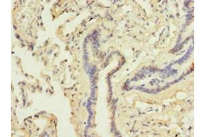 Immunohistochemistry of paraffin-embedded human lung tissue using ABIN7144990 at dilution of 1:100 (DDX42 anticorps  (AA 519-819))