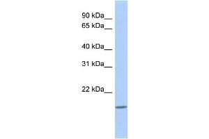 WB Suggested Anti-CLECL1 Antibody Titration: 0. (CLECL1 anticorps  (N-Term))