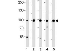 Western blot analysis of lysate from (1) MDA-MB-468, (2) SW620, (3) T47D cell line, (4) mouse spleen, (5) mouse testis tissue using EZH2 antibody at 1:1000. (EZH2 anticorps)