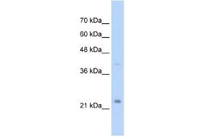 MUC1 antibody used at 2. (MUC1 anticorps  (C-Term))