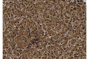 ABIN6261588 and ABIN6277499 at 1/100 staining Human liver tissue by IHC-P.