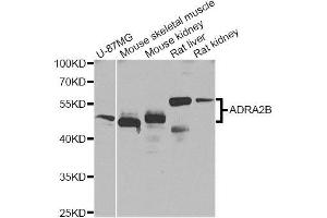 Western blot analysis of extracts of various cell lines, using ADRA2B Antibody (ABIN5996019) at 1/1000 dilution. (ADRA2B anticorps)