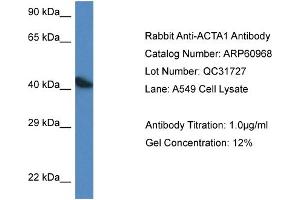 Western Blotting (WB) image for anti-Actin, alpha 1, Skeletal Muscle (ACTA1) (C-Term) antibody (ABIN786304) (Actin anticorps  (C-Term))