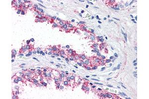 Anti-5HT1B Receptor antibody IHC of human prostate.