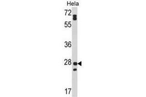 Image no. 1 for anti-Family with Sequence Similarity 3, Member B (FAM3B) (N-Term) antibody (ABIN452988) (FAM3B anticorps  (N-Term))