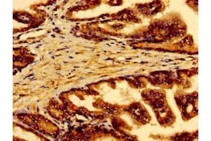 Immunohistochemistry of paraffin-embedded human prostate tissue using ABIN7167354 at dilution of 1:100