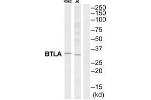 Western blot analysis of extracts from K562/Jurkat cells, using BTLA antibody. (BTLA anticorps  (C-Term))