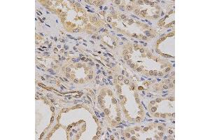 Immunohistochemistry of paraffin-embedded human kidney using ATP6AP1 antibody at dilution of 1:200 (x400 lens). (ATP6AP1 anticorps  (AA 90-390))