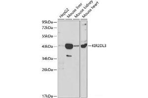 Western blot analysis of extracts of various cell lines using KIR2DL3 Polyclonal Antibody at dilution of 1:1000. (KIR2DL3 anticorps)