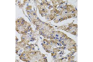 Immunohistochemistry of paraffin-embedded human stomach using CAST antibody. (Calpastatin anticorps)