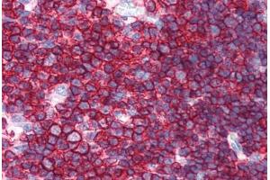 Human Thymus (formalin-fixed, paraffin-embedded) stained with SPN antibody ABIN351514 at 10 ug/ml followed by biotinylated anti-mouse IgG secondary antibody ABIN481714, alkaline phosphatase-streptavidin and chromogen. (CD43 anticorps)