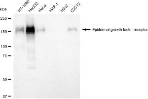 Western blotting analysis using epidermal growth factor receptor antibody (ABIN7798478).
