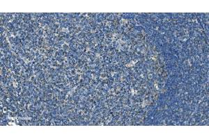 IHC analysis of IL37 using anti-IL37 antibody (ABIN7601794). (IL-37 anticorps  (AA 46-218))