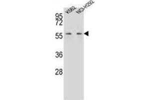 Western blot analysis in K562,NCI-H292 cell line lysates (35ug/lane) using MPP3 Antibody (C-term). (MPP3 anticorps  (C-Term))