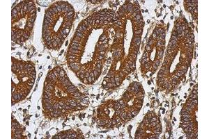 Image no. 1 for anti-Abhydrolase Domain Containing 16A (ABHD16A) (AA 14-261) antibody (ABIN1496390)