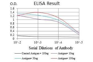 Black line: Control Antigen (100 ng), Purple line: Antigen(10 ng), Blue line: Antigen (50 ng), Red line: Antigen (100 ng), (NEFL anticorps)