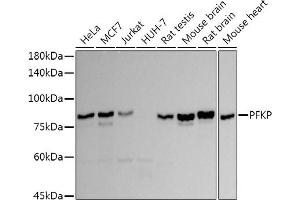 Western blot analysis of extracts of various cell lines, using PFKP antibody (ABIN7269309) at 1:1000 dilution. (PFKP anticorps)