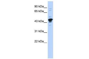 RBMXL2 antibody used at 1 ug/ml to detect target protein.