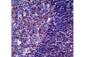 CD5 antibody immunohistochemistry analysis in formalin fixed and paraffin embedded human tonsil tissue.